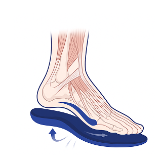 Arch Support